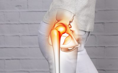 Trochanteric Bursitis & Lateral/Outside Hip Pain